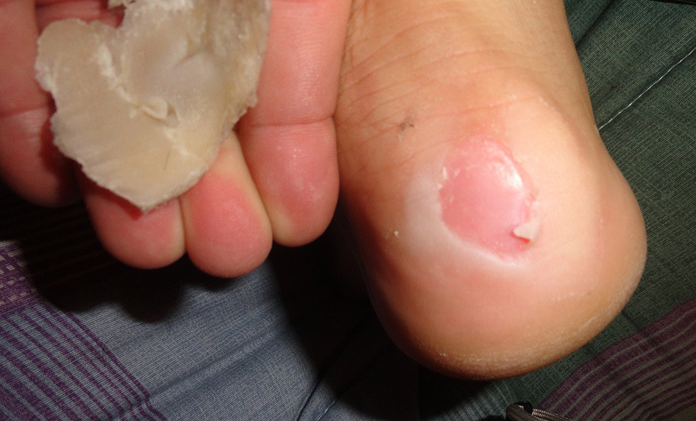 Foto: Rosier Alexandre